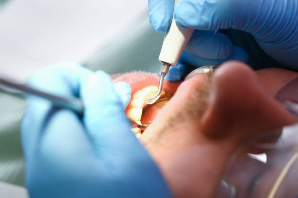 Best Cracked Tooth Emergency Dentist  in Rainbow Lakes Estates, FL