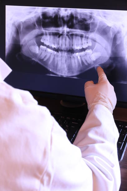 Best Broken Tooth Emergency  in Rainbow Lakes Estates, FL
