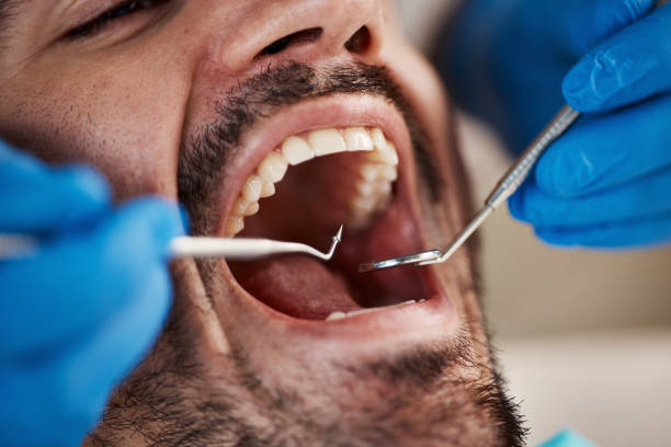 Best Emergency Tooth Extraction  in Rainbow Lakes Estates, FL