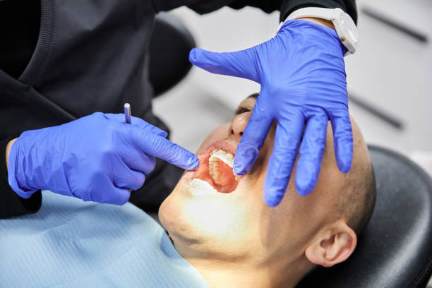 Best Dentist for Tooth Abscess  in Rainbow Lakes Estates, FL